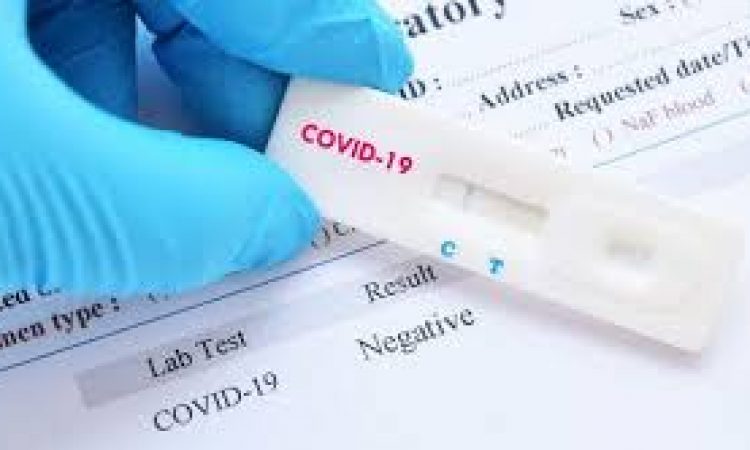 SAÚDE CONFIRMA 64 CASOS POSITIVOS COVID-19