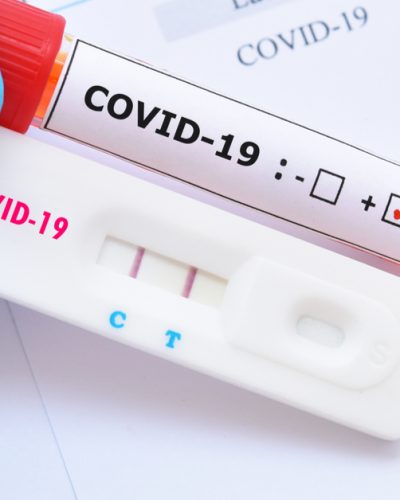 49 CASOS POSITIVOS COVID-19 NO MUNICÍPIO