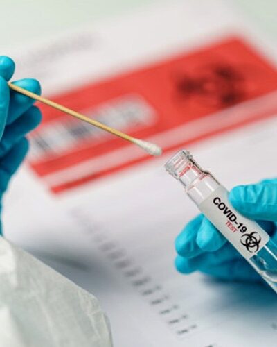 ATUALIZAÇÃO DA SAÚDE CONFIRMA 587 CASOS DE COVID