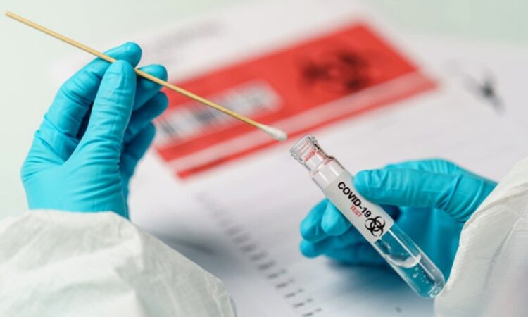 ATUALIZAÇÃO DA SAÚDE CONFIRMA 587 CASOS DE COVID
