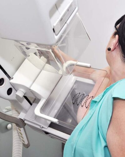 SAÚDE AGENDA EXAMES DE MAMOGRAFIA NO MUTIRÃO