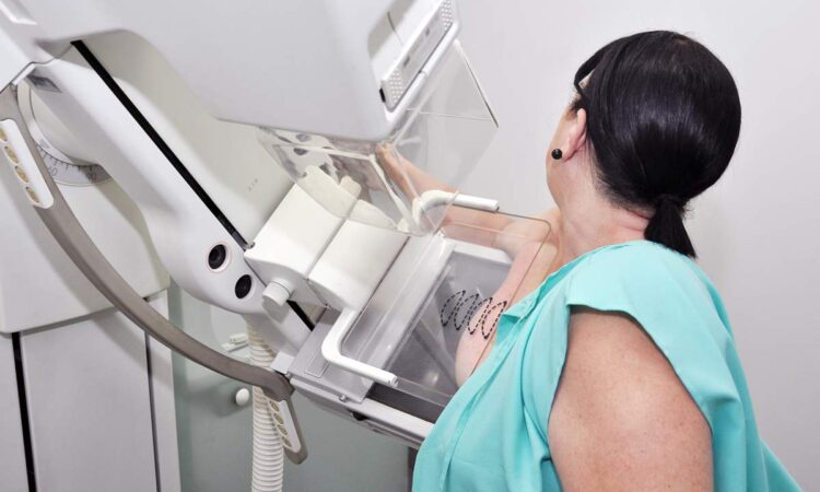 SAÚDE AGENDA EXAMES DE MAMOGRAFIA NO MUTIRÃO