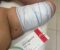IMPLANON – Método Contraceptivo (evitar gravidez não planejada) de alta eficácia